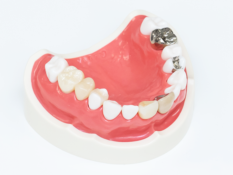 セラミック 見本